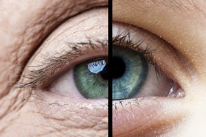 5 etapw starzenia si okolicy oka [© Vera Kuttelvaserova - Fotolia.com]