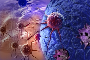 6 objawów raka, które ludzie zwykle ignorują [Fot. vitanovski - Fotolia.com]