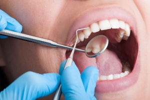 6 powodów, dla których warto dbać o zęby [Fot. Catalin Pop - Fotolia.com]