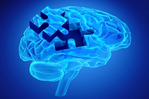 „Pamitaj o mnie” - obchody wiatowego Dnia Choroby Alzheimera 2016  [© goa novi - Fotolia.com]