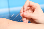 Akupunktura "lekiem" na niezdiagnozowane choroby [© kreativwerden - Fotolia.com]