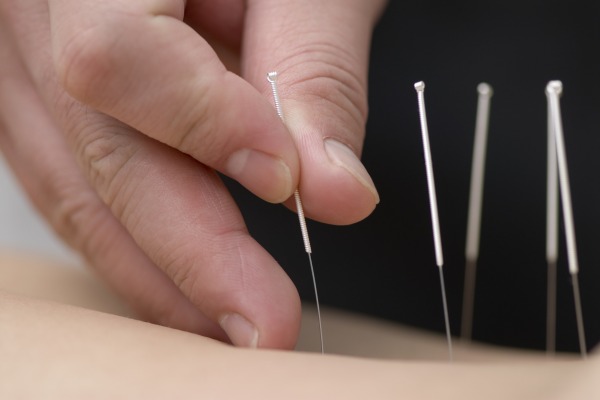 Akupunktura sposobem na stres? [Fot. Max Tactic - Fotolia.com]