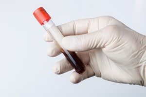 Badanie krwi pozwoli przewidzie zawa [© StudioLaMagica - Fotolia.com]
