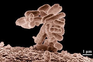 Bakteria E. coli oporna na wszelkie antybiotyki odkryta w USA [fot. WikiImages / Pixabay.com, CC0 Public Domain]