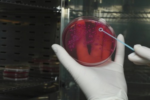 Bakterie E. coli kluczem do opracowania leku na chorob Alzheimera? [© Andrea Catellani - Fotolia.com]