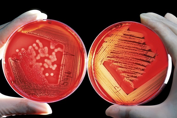 Bakterie też mają wpływ na ryzyko zawału [fot. WikiImages z Pixabay]