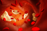 Cholesterol - bajka o dobrym i zym bracie [© frenta - Fotolia.com]