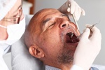 Choroby dzise a udar i rak jamy ustnej [© Adam Gregor - Fotolia.com]