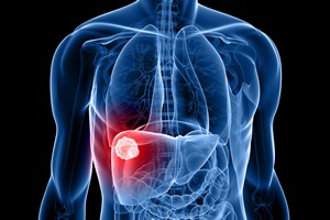 Cukrzyca zwiększa ryzyko raka wątroby [© Sebastian Kaulitzki - Fotolia.com]