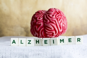 Czy to Alzheimer? Krtki poradnik [Fot. aytuncoylum - Fotolia.com]