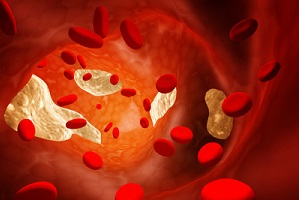 Dobry i zy cholesterol - najwaniejsze s proporcje [fot. Tajemniczy cholesterol]