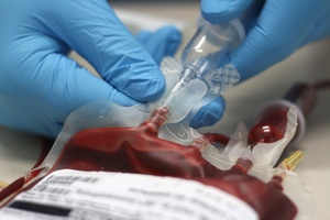 Eliksir modoci? Transfuzje krwi odmodziy mzgi myszy [© sebgross - Fotolia.com]