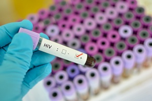 Epidemia HIV nie sabnie [© jarun011 - Fotolia.com]
