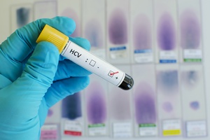HCV: niebezpieczna pamitka z wakacji [© jarun011 - Fotolia.com]