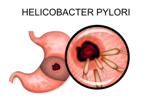 Infekcja Helicobacter zwiksza ryzyko raka odka [Fot. Artemida-psy - Fotolia.com]