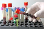 Jak chroni si przed HIV? [© nenovbrothers - Fotolia.com]