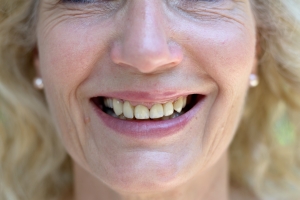 Jak dba o zby w menopauzie? [Fot. michaelheim - Fotolia.com]