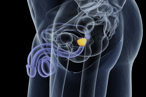 Jakie są objawy raka prostaty [Fot. Anatomy Insider - Fotolia.com]