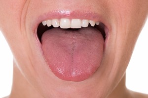 Jzyk: wskanik Twojego zdrowia [©  Andrey Popov - Fotolia.com]