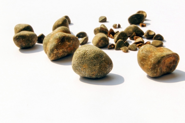 Kamienie żółciowe - czy można rozpoznać ich obecność? [Fot. jozsitoeroe - Fotolia.com]