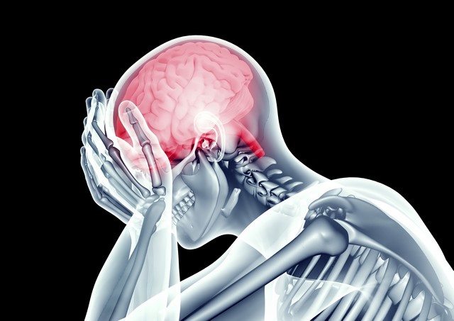Klasterowe bóle głowy oznaczają wyższe ryzyko innych chorób [© the_lightwriter - Fotolia.com]