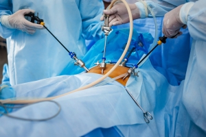 Laparoskopia. Precyzyjna chirurgia dla zdrowia kobiet [Fot. flywish - Fotolia.com]