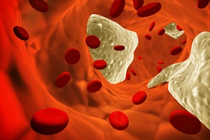 Miadyca - cholesterol [© frenta - Fotolia.com]