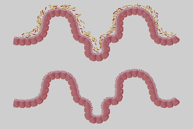 Mikrobiom jelitowy wpływa na skuteczność odchudzania [fot. LJNovaScotia from Pixabay]