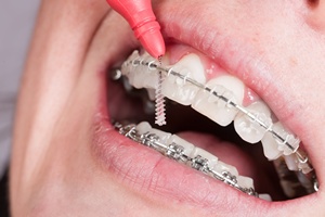 Na proste zby nigdy za pno. Ortodonta rwnie dla dorosych [© StudioLaMagica - Fotolia.com]