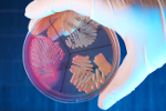 Naukowcy odkryli koszt odpornoci bakterii na antybiotyki [©  Alexander Raths - Fotolia.com]