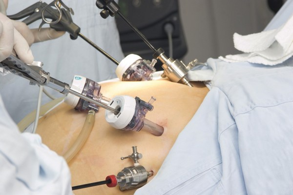 Operacja bariatryczna odwraca szkodliwe efekty cukrzycy [© reflektastudios - Fotolia.com]