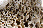 Osteoporoza - (nie)mska sprawa? [© Jeanet Dijkstra - Fotolia.com]