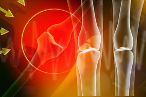Oto, czego nie wiesz o osteoporozie [© krishnacreations - Fotolia.com]