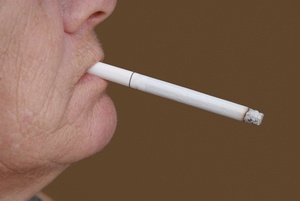 Palenie papierosw przyczynia si do utraty zbw [© Bronwyn Photo - Fotolia.com]