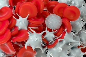 Przewleka biaaczka limfocytowa. Najczstszy nowotwr krwi u seniorw bdzie w Polsce skutecznie leczony? [Fot. royaltystockphoto - Fotolia.com]