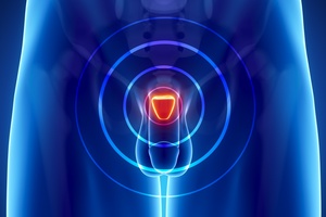 Rak prostaty: objawy, diagnostyka, leczenie [© CLIPAREA.com - Fotolia.com]
