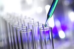Rak szyjki macicy wykrywany szybciej przez testy DNA HPV ni cytologi? [© Olivier - Fotolia.com]