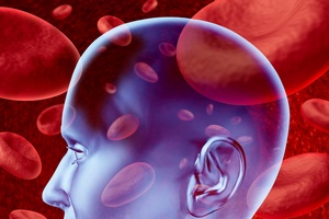 Ratunek przed udarem: sprawne krenie mzgowe  [©  freshidea - Fotolia.com]