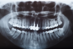 Rentgen u dentysty: co warto wiedzie? [Fot. olmarmar - Fotolia.com]