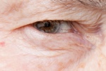 Retinopatia a zaburzenia poznawcze [© Nickolay Khoroshkov - Fotolia.com]