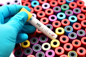 wiatowy Dzie AIDS: rozmawiaj o HIV  [Fot. jarun011 - Fotolia.com]