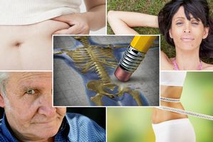 Tego o osteoporozie mogłeś nie wiedzieć. 4 ciekawe fakty [fot. collage Senior.pl]