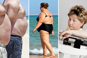 Uczeni zidentyfikowali sześć grup otyłych ludzi [fot. collage Senior.pl]