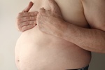 Utrata na wadze sposobem na uniknicie licznych wizyt lekarskich [© nebari - Fotolia.com]