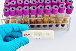 Wirus HCV niszczy organizm. Wikszo zakaonych niewiadoma [HCV, © jarun011 - Fotolia.com]