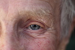 Wygld oczu a choroby serca [© galam - Fotolia.com]