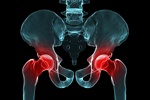 Wymiana stawu biodrowego lub kolanowego a ryzyko zawau [© Sebastian Kaulitzki - Fotolia.com]