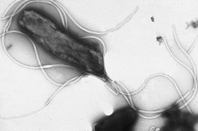 Zakaenie bakteri H. Pylori moe mie zwizek z rozwojem choroby Parkinsona [fot. Yutaka Tsutsumi, Public Domain]