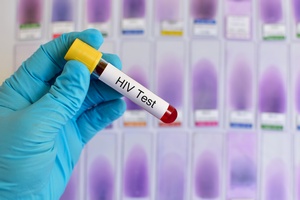 Zatrzyma AIDS. Epidemia trwa [© jarun011 - Fotolia.com]